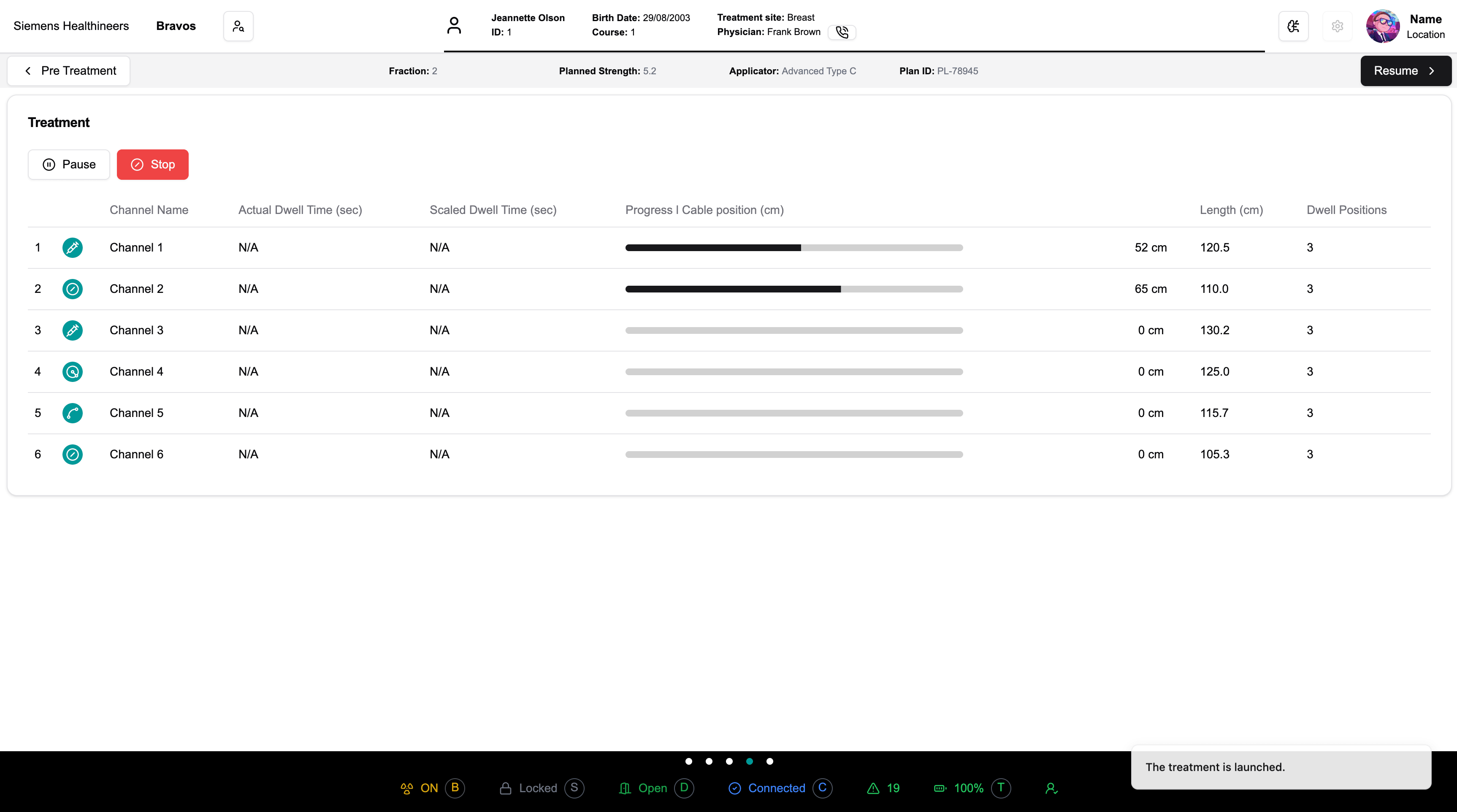 Redesigned brachytherapy planning interface